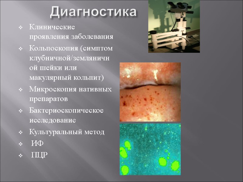 Диагностика  Клинические проявления заболевания Кольпоскопия (симптом клубничной/земляничной шейки или макулярный кольпит) Микроскопия нативных